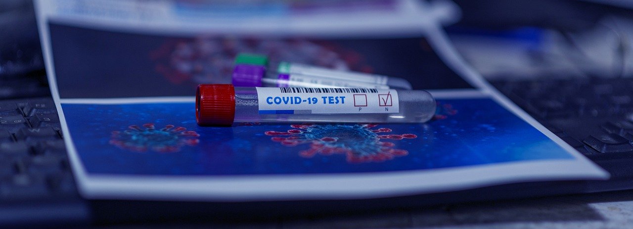 CDC changes guidelines for testing: No more test for asymptomatics