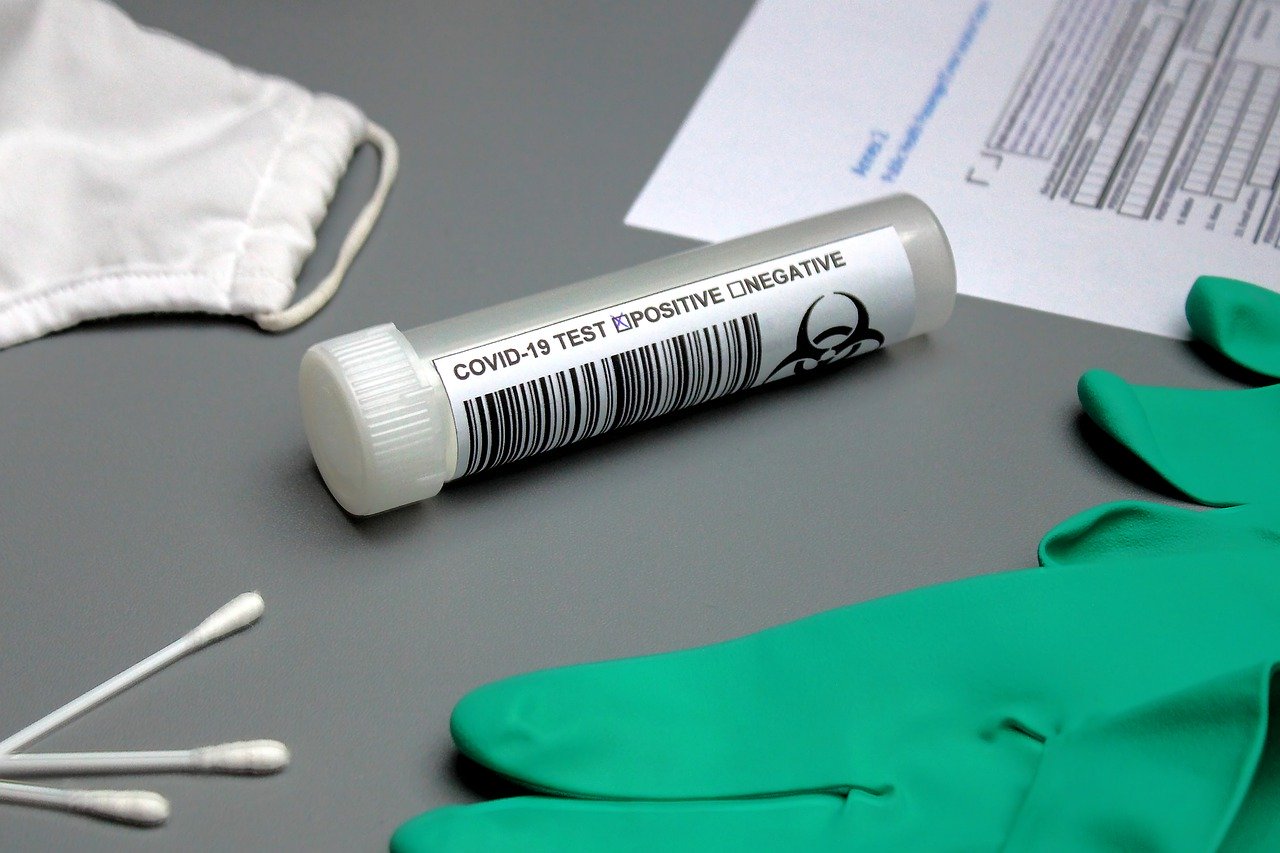 Sweden discovers 3,700 false positives from test kit