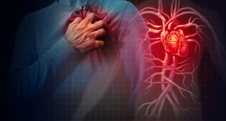 The Pandemic of Heart Attacks Caused by Blood Clots